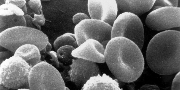 Scanning Electron Microscope Image of Blood Cells
