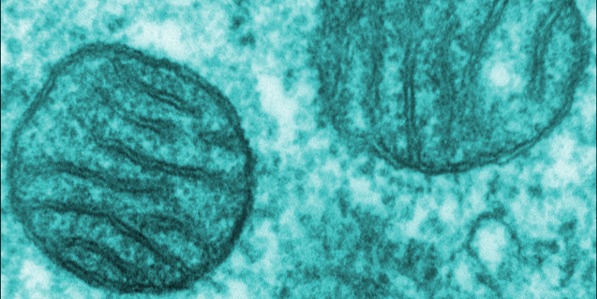 Mitochondria, mammalian lung - TEM